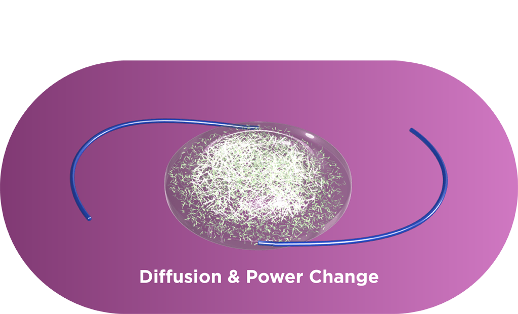 Unpolymerized macromers move into the exposed area, causing precise shape and power change.