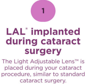 Infographic step 1: "LAL implanted during cataract surgery" — The Light Adjustable Lens is placed during your cataract procedure, similar to standard cataract surgery