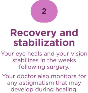 Infographic step 2: "Recovery and stabilization" — Your eye heals and vision stabilizes in the weeks following surgery while your doctor monitors for astigmatism