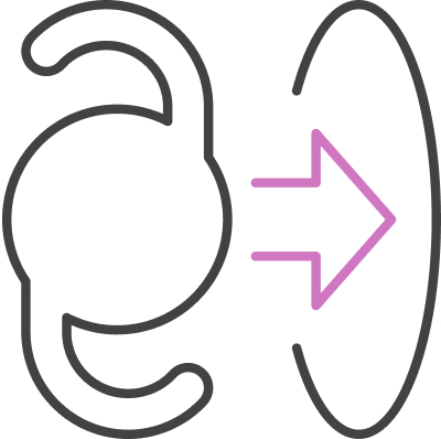 Line icon of an intraocular lens with an arrow pointing toward an eye, representing IOL exchange.